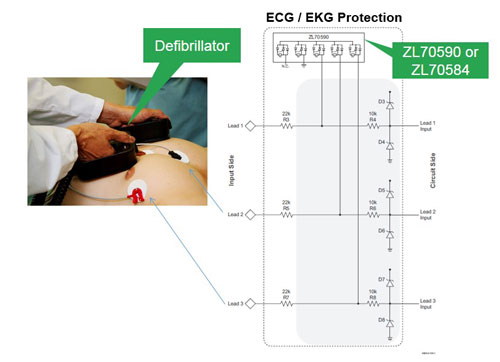 ECG EKG Protection Circuit | Microsemi
